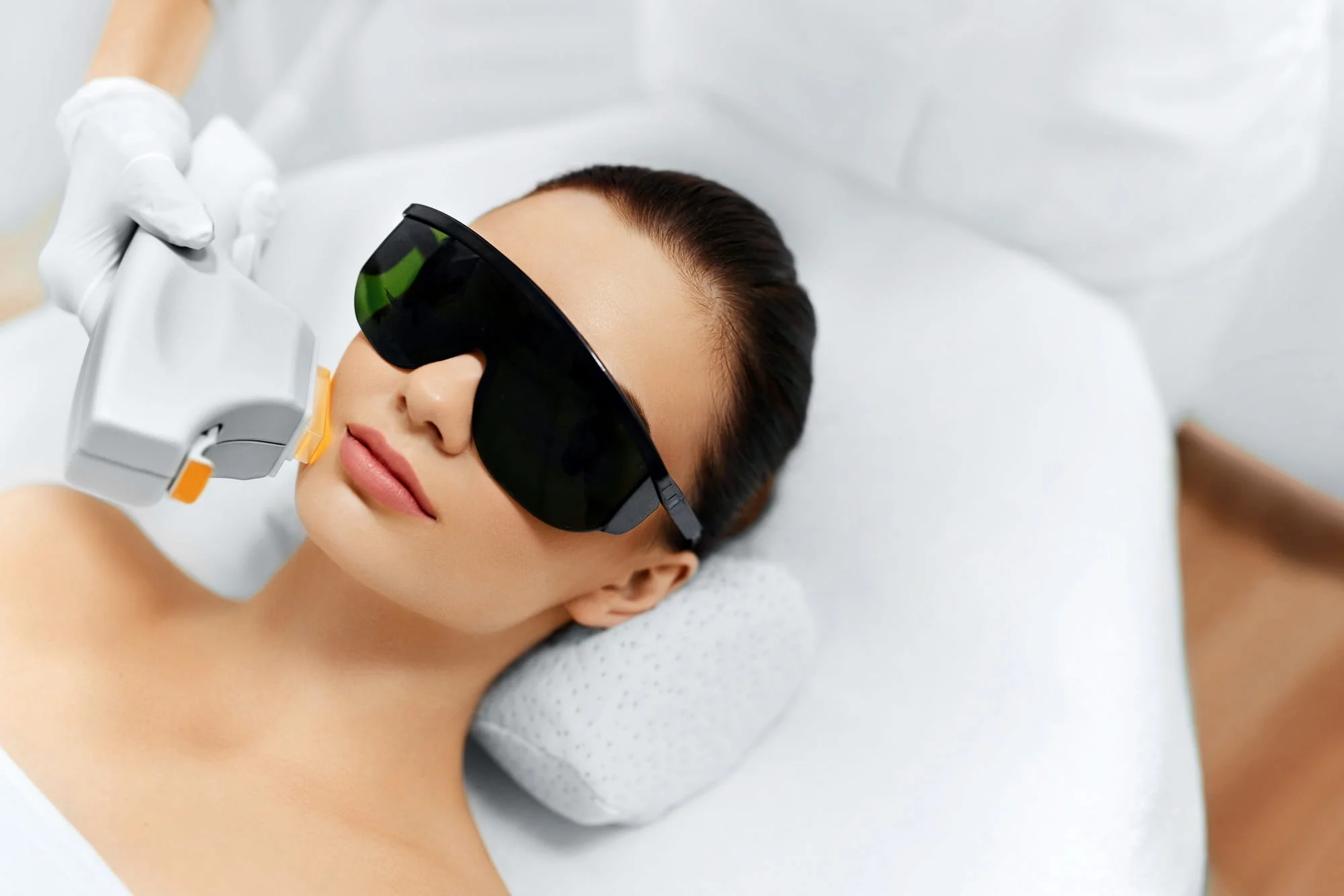 What is the Cost and What to Expect from Your LimeLight IPL Treatment